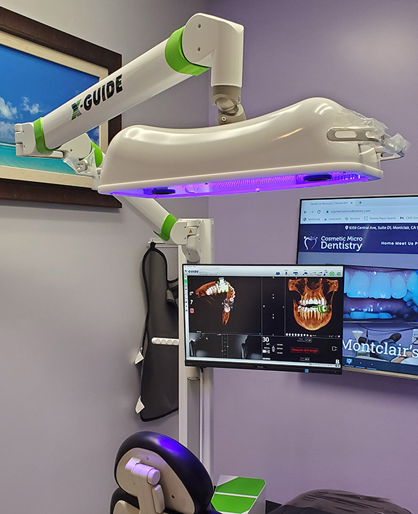 Cosmetic Micro Dentistry | Intraoral Camera, 3D HD Stereoscopic Microscopy and Glidewell In-Office Mill
