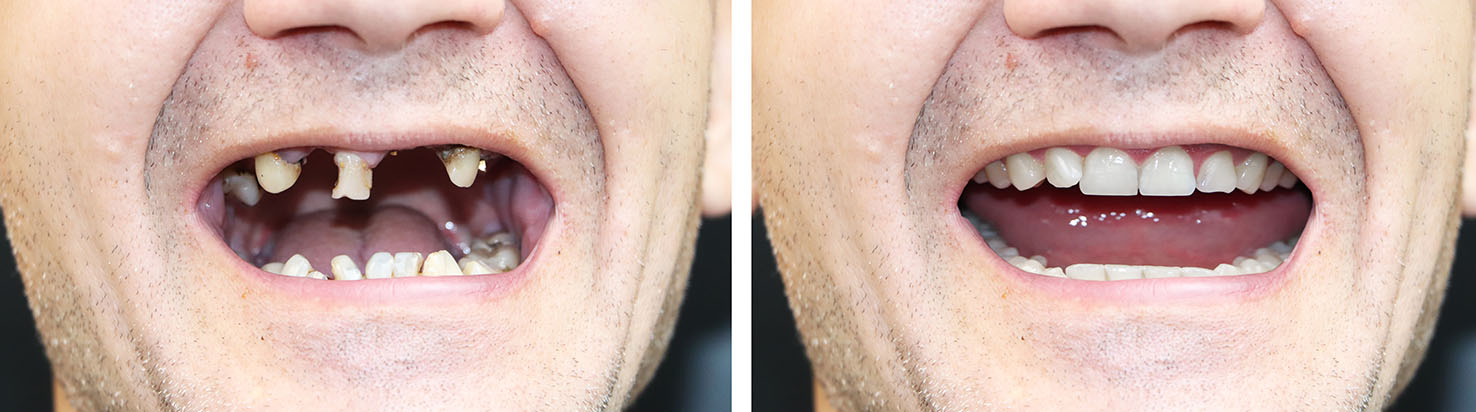 Cosmetic Micro Dentistry | Dental Cleanings, Digital Radiography and Root Canals