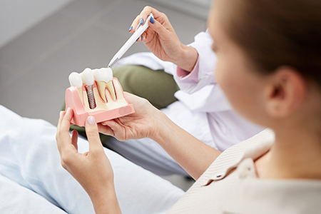 Cosmetic Micro Dentistry | Glidewell In-Office Mill, Dental Fillings and Dental Bridges